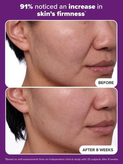 PAULA'S CHOICE 1% Retinol Treatment (30ml)