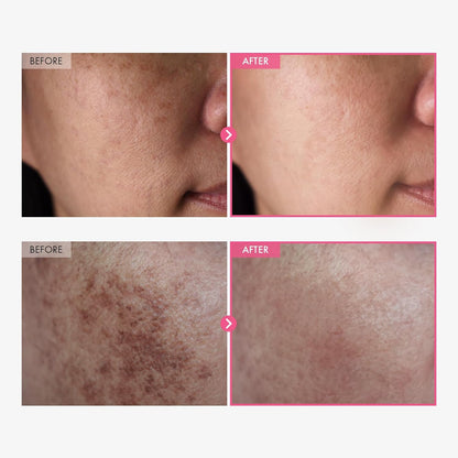 TOSOWOONG Arbutin 7% + Tranexamic Acid 4% Cream (50ml)