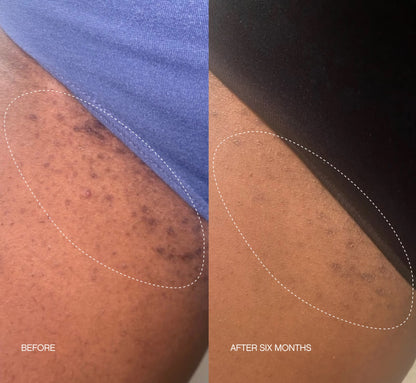 TOPICALS High Roller Ingrown Tonic (50ml)