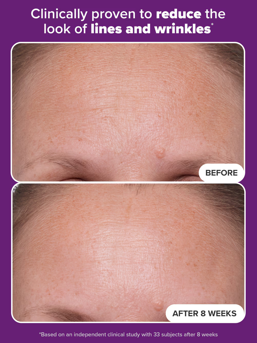 PAULA'S CHOICE 1% Retinol Treatment (30ml)