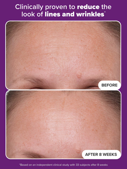 PAULA'S CHOICE 1% Retinol Treatment (30ml)